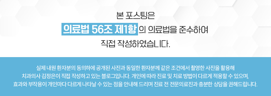 삐뚤빼뚤한 치열 교정 비발치, 미니스크류 식립 케이스, 턱관절 검사