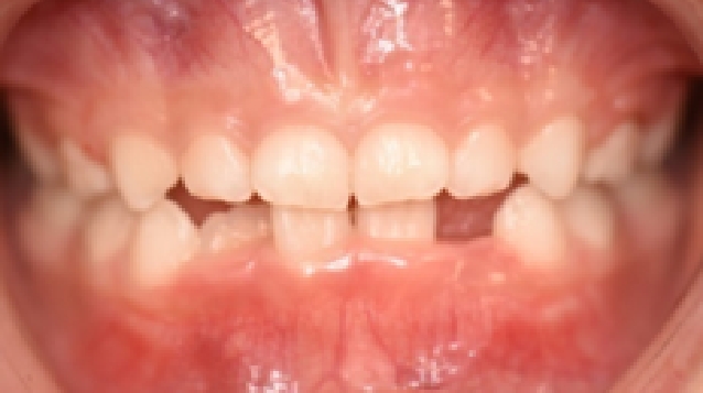 치료 후